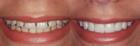 cosmetic dentist in Sandy photo